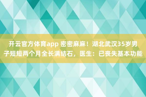 开云官方体育app 密密麻麻！湖北武汉35岁男子短短两个月全长满结石，医生：已丧失基本功能